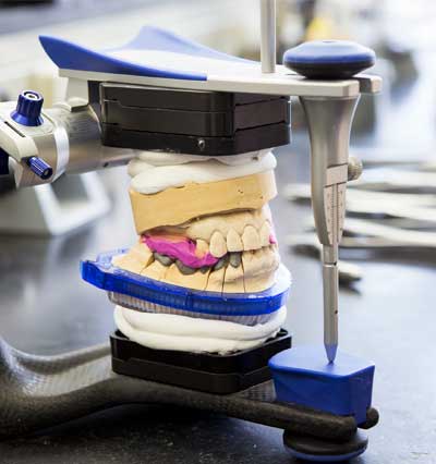 Dental-Präzisionsarbeit